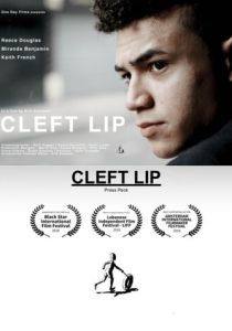 Заячья губа 2017